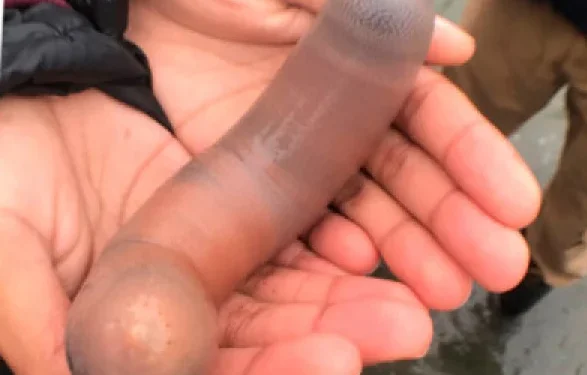 Thousands of “penis fish” washed ashore after a severe storm
